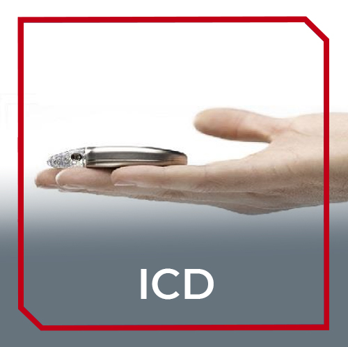 What is an ICD?